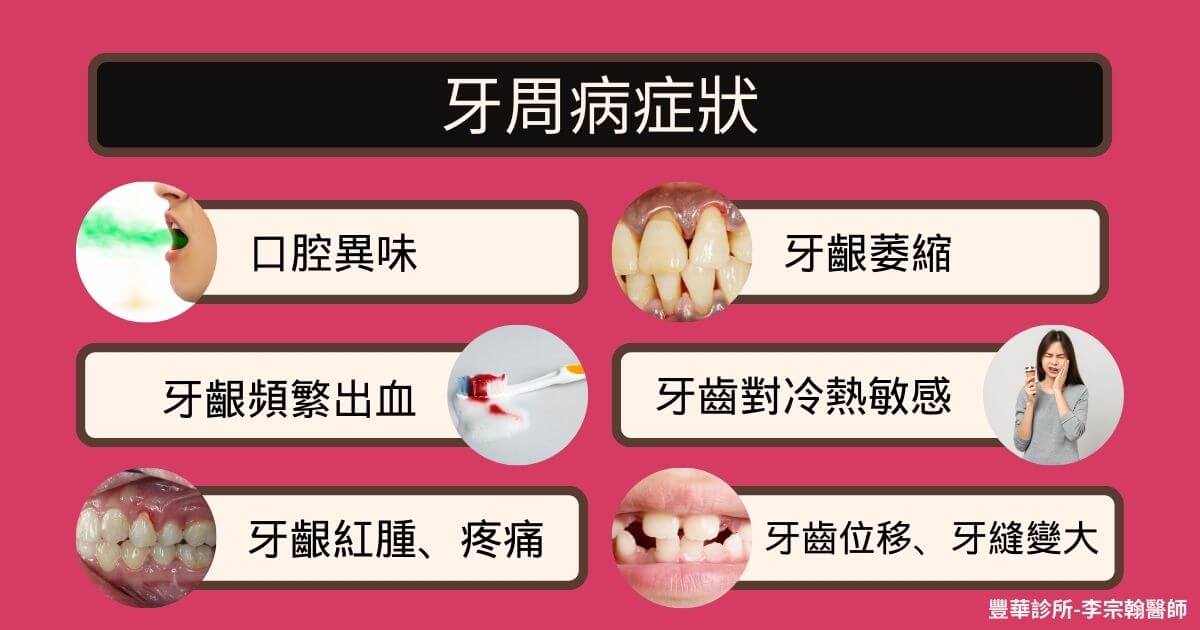牙周病症狀整理