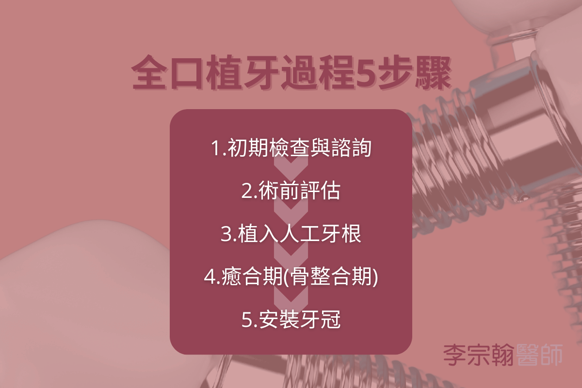 全口植牙過程是怎麼進行的？